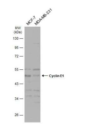 Western Blot: Cyclin E1 Antibody [NBP2-16055]