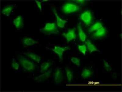 Immunocytochemistry/ Immunofluorescence: Cyclin G2 Antibody (1F9-C11) [H00000901-M01]