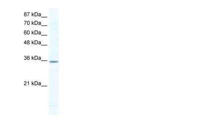Western Blot: Cyclin G2 Antibody [NBP1-79935]