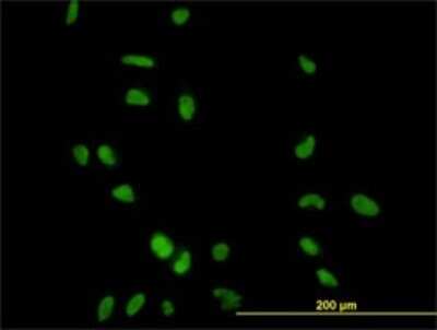 Immunocytochemistry/ Immunofluorescence: Cyclin H Antibody (1B8) [H00000902-M01]