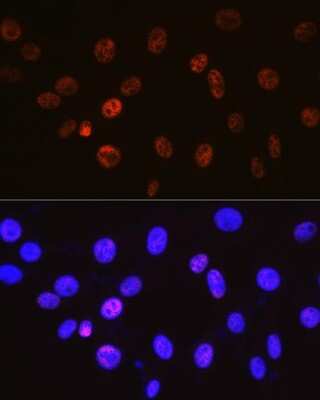 Immunocytochemistry/ Immunofluorescence: Cyclin H Antibody (3N5S3) [NBP3-16325]