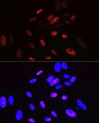 Immunocytochemistry/ Immunofluorescence: Cyclin H Antibody (3N5S3) [NBP3-16325]
