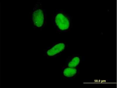 Immunocytochemistry/ Immunofluorescence: Cyclin H Antibody [H00000902-B01P]