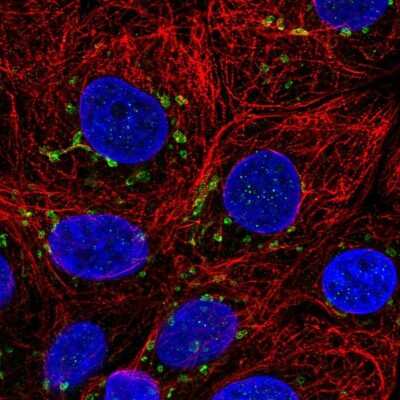 Immunocytochemistry/ Immunofluorescence: Cyclin I Antibody [NBP2-56916]