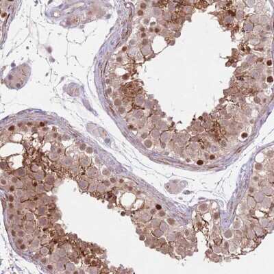 Immunohistochemistry: Cyclin I Antibody [NBP2-34060]