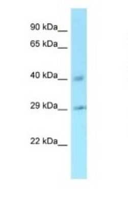 Western Blot: Cyclin J Antibody [NBP1-98569]