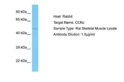Western Blot: Cyclin J Antibody [NBP1-98569]