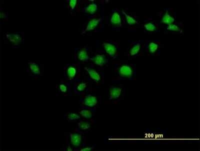 Immunocytochemistry/ Immunofluorescence: Cyclin M3 Antibody [H00026505-B01P]