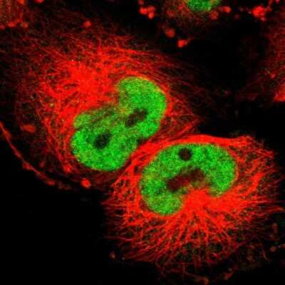 Immunocytochemistry/ Immunofluorescence: Cyclin T1 Antibody [NBP3-05509]
