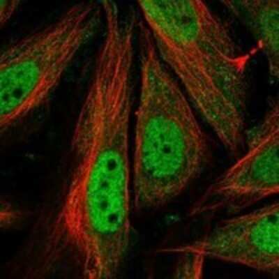 Immunocytochemistry/ Immunofluorescence: Cyclin T1 Antibody [NBP3-17238]