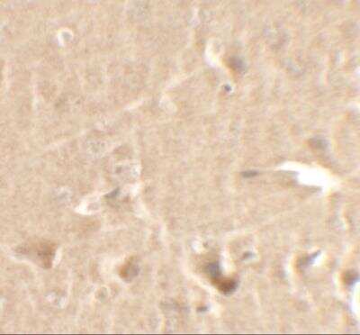 Immunohistochemistry: Cyclin T1 Antibody - BSA Free [NBP2-81898]