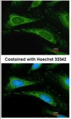 Immunocytochemistry/ Immunofluorescence: Cyclophilin A Antibody [NBP1-30993]