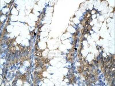 Immunohistochemistry-Paraffin: Cyclophilin A Antibody [NBP1-54388]