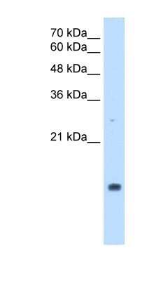 Western Blot: Cyclophilin A Antibody [NBP1-54388]