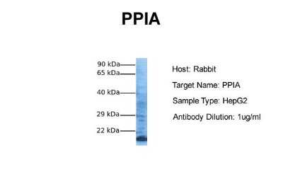 Western Blot: Cyclophilin A Antibody [NBP1-54388]