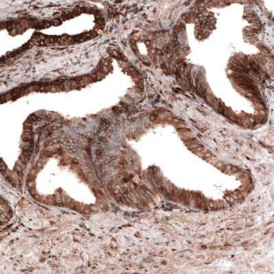 Immunohistochemistry-Paraffin: Cyclophilin B Antibody (CL3901) [NBP2-59781]