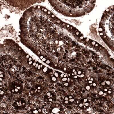 Immunohistochemistry-Paraffin: Cyclophilin B Antibody (CL3901) [NBP2-59781]