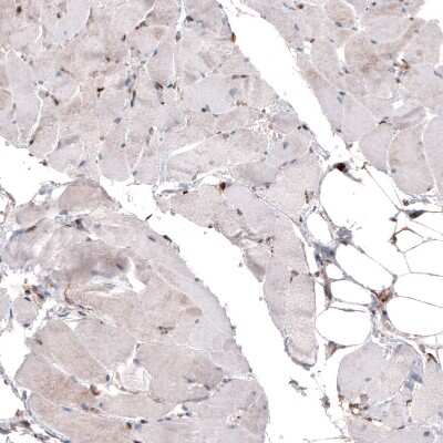 Immunohistochemistry-Paraffin: Cyclophilin B Antibody (CL3901) [NBP2-59781]