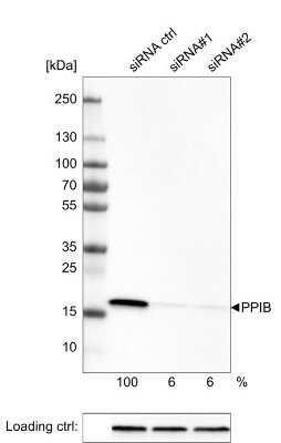 Western Blot: Cyclophilin B Antibody (CL3901) [NBP2-59781]