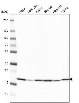 Western Blot: Cyclophilin B Antibody (CL3901) [NBP2-59781]
