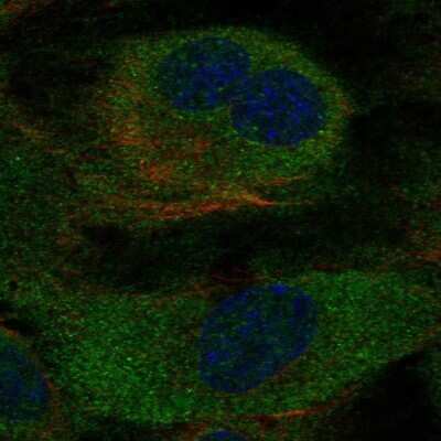 Immunocytochemistry/ Immunofluorescence: Cyclophilin B Antibody [NBP1-85358]