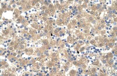 Immunohistochemistry-Paraffin: Cyclophilin B Antibody [NBP1-62356]