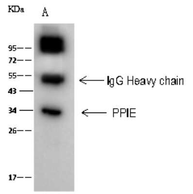 Immunoprecipitation: Cyclophilin-E Antibody [NBP2-99016]