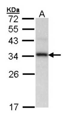 Western Blot: Cyclophilin-E Antibody [NBP1-33471]