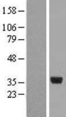 Western Blot: Cyclophilin-E Overexpression Lysate [NBL1-14649]