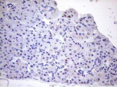 Immunohistochemistry: Cyclophilin-F Antibody (OTI1G8) [NBP2-45380]