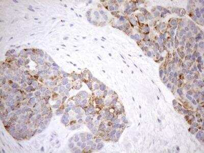 Immunohistochemistry: Cyclophilin-F Antibody (OTI1G8) [NBP2-45380]
