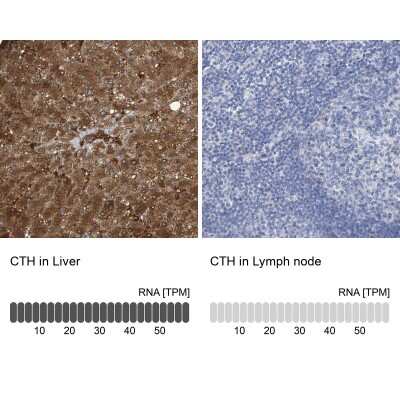 Immunohistochemistry-Paraffin: Cystathionase Antibody [NBP1-86016]