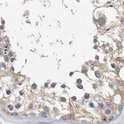 Immunohistochemistry-Paraffin: Cystathionase Antibody [NBP1-90362]
