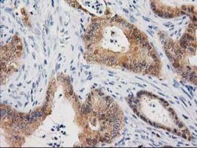 Immunohistochemistry: Cystathionase Antibody (OTI1E12) - Azide and BSA Free [NBP2-70488]