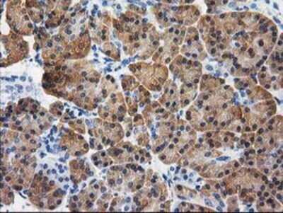 Immunohistochemistry: Cystathionase Antibody (OTI1E12) - Azide and BSA Free [NBP2-70488]