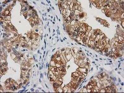 Immunohistochemistry-Paraffin: Cystathionase Antibody (OTI1E12) [NBP2-03638]