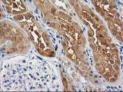 Immunohistochemistry-Paraffin: Cystathionase Antibody (OTI1E12) [NBP2-03638]