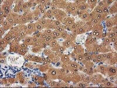 Immunohistochemistry-Paraffin: Cystathionase Antibody (OTI1E12) [NBP2-03638]