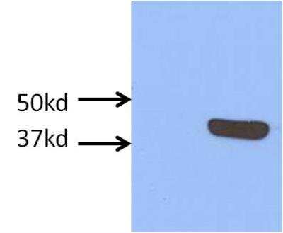 Western Blot: Cystathionase Antibody [NBP1-52849]