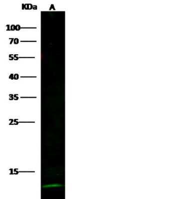 Western Blot: Cystatin A Antibody (236) [NBP2-89524]