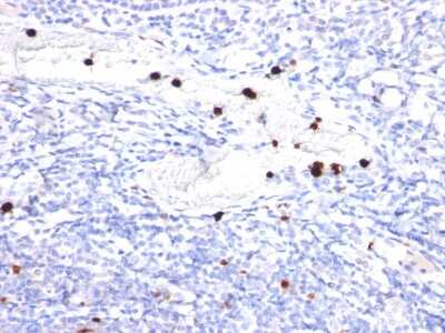 Immunohistochemistry-Paraffin: Cystatin A Antibody (CPTC-CSTA-1) - Azide and BSA Free [NBP3-08498]
