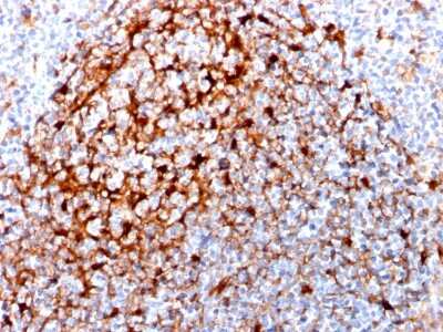 Immunohistochemistry-Paraffin: Cystatin A Antibody (CPTC-CSTA-1) [NBP3-07781]