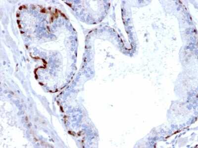 Immunohistochemistry-Paraffin: Cystatin A Antibody (CPTC-CSTA-1) [NBP3-07781]