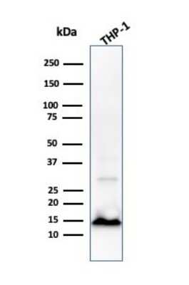 Western Blot: Cystatin A Antibody (CPTC-CSTA-1) [NBP3-07781]