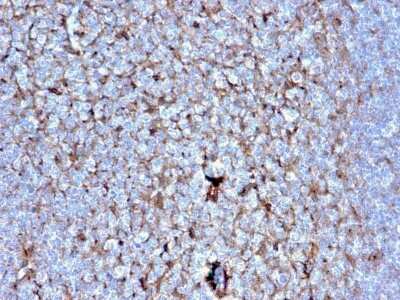 Immunohistochemistry-Paraffin: Cystatin A Antibody (CSTA/2882) [NBP2-79747]