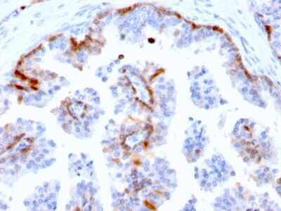 Immunohistochemistry-Paraffin: Cystatin A Antibody (CSTA/2882) [NBP2-79747]