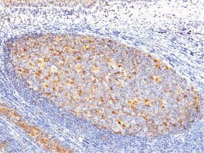 Immunohistochemistry-Paraffin: Cystatin A Antibody [NBP2-99326]