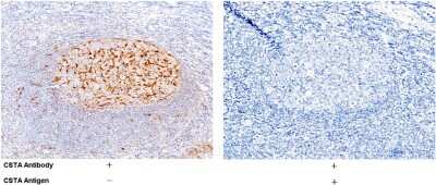 Immunohistochemistry-Paraffin: Cystatin A Antibody [NBP2-99327]