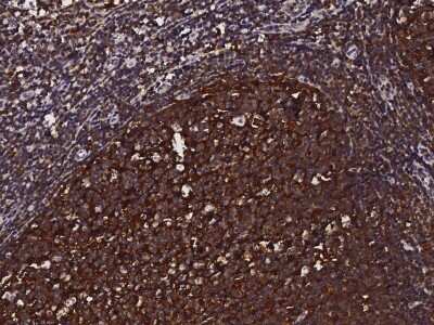 Immunohistochemistry-Paraffin: Cystatin A Antibody [NBP2-99328]