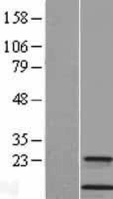 Western Blot: Cystatin A Overexpression Lysate [NBL1-09553]